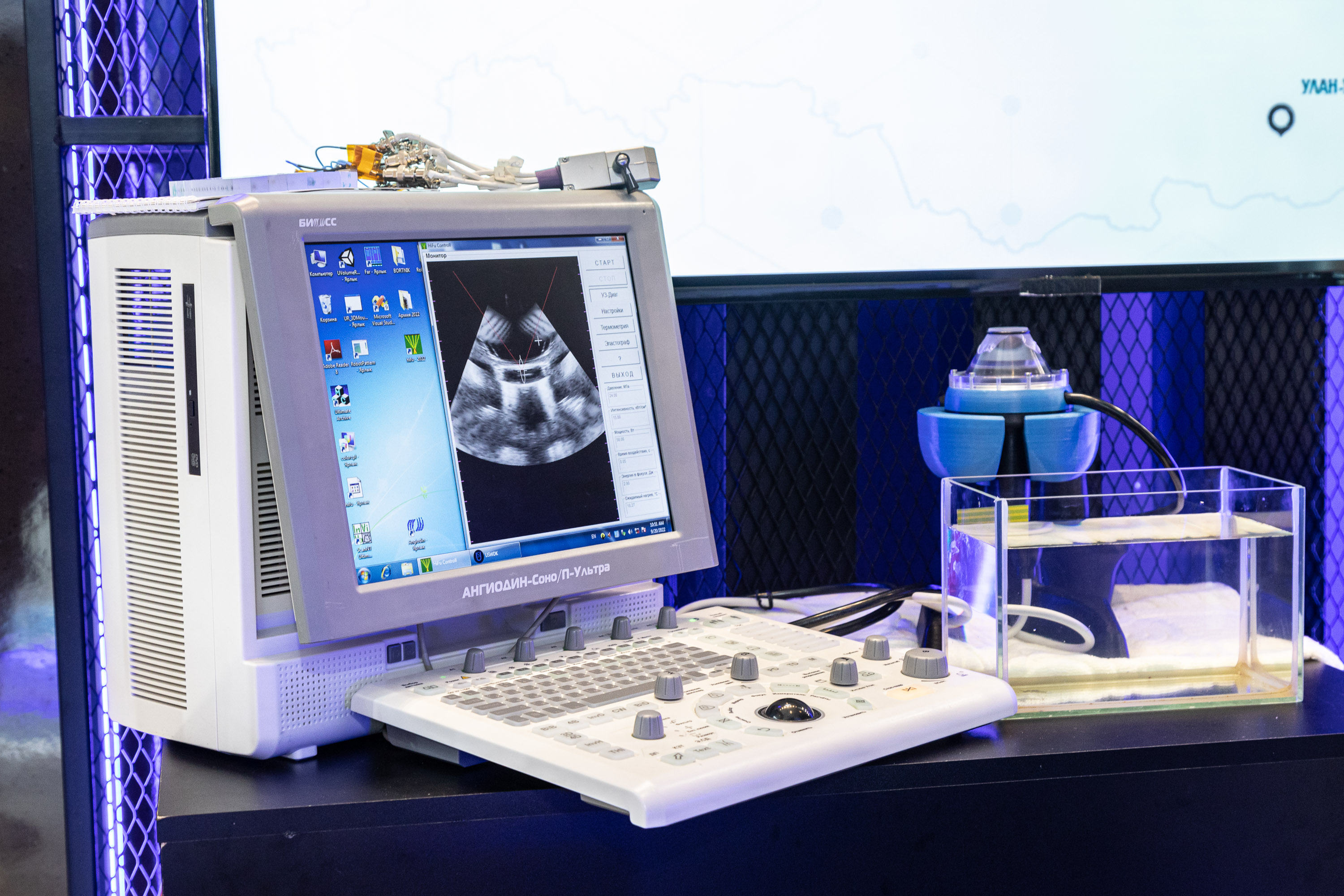 Ростех впервые представил новейшее оборудование для ультразвуковой диагностики и лечения рака