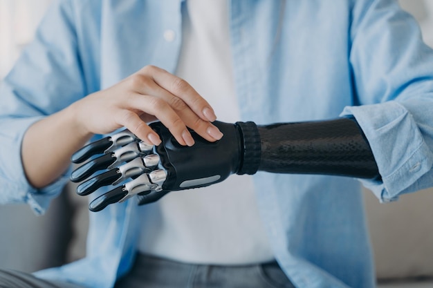 Rostec and Aluminiy Metallurg Rus to Launch the Manufacture of Exoprostheses 