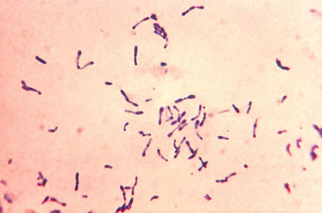 Corynebacterium_diphtheriae_Gram_stain.jpg Corynebacterium_diphtheriae_Gram_stain.jpg